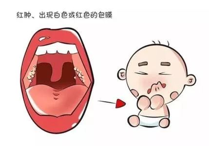 孩子发烧反复是什么原因怎么办