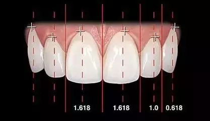 牙齿的10大美学标准,你符合几条?