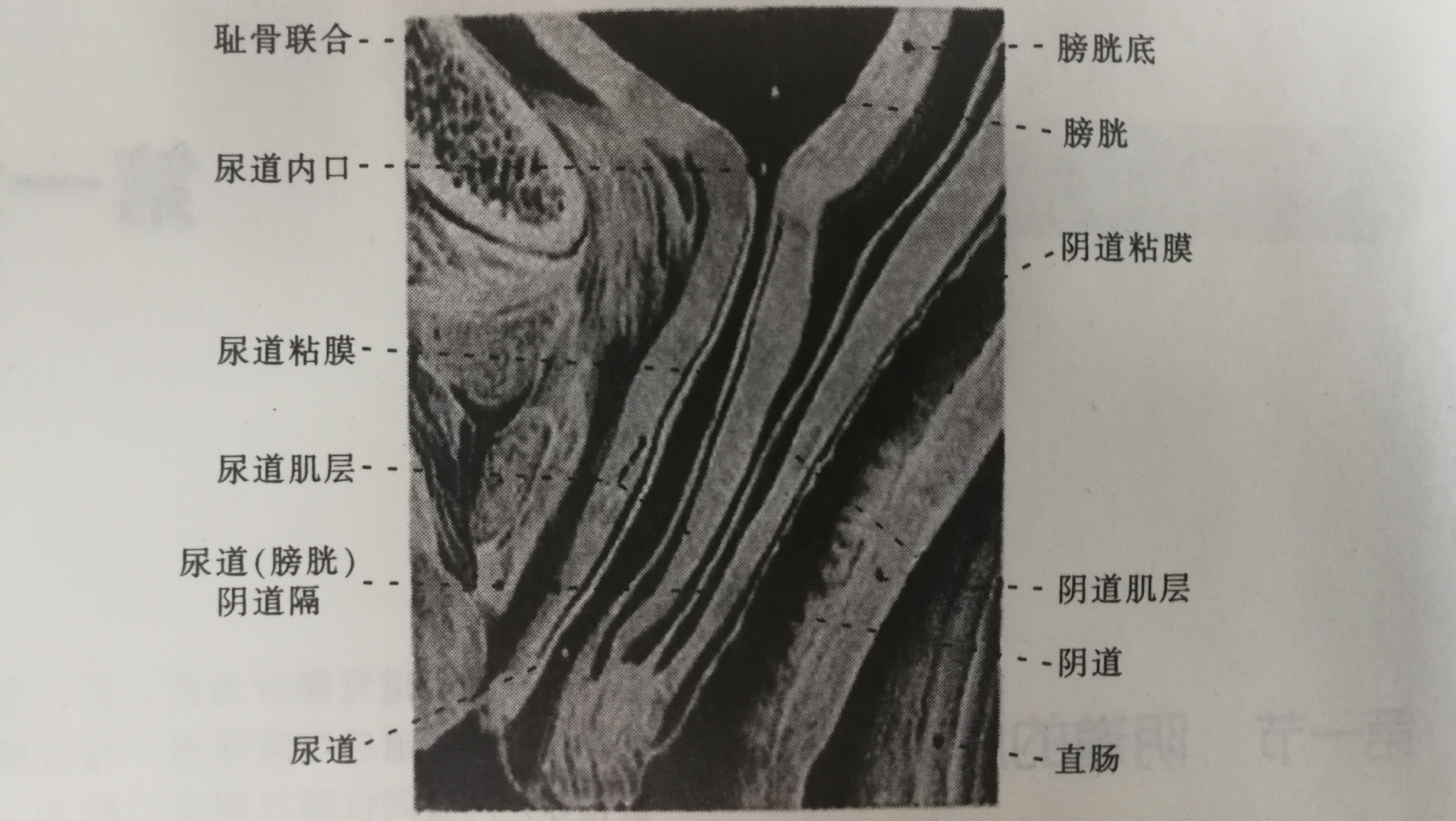 原创生理卫生课阴道的形态