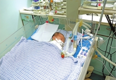 宝宝左右心房血管搭错 出生13小时开胸手术幸运存活