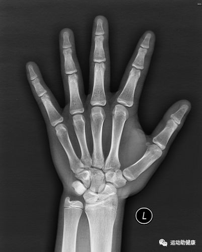 ①家长需提供孩子的一张x光片(左手整个手掌及手腕部,请自费到医院
