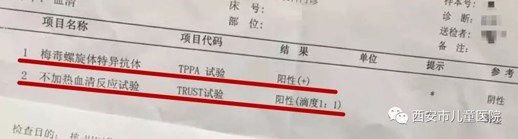 阴性 阳性 既往感染;现症感染经治疗后;处于一期梅毒早期或三期梅毒