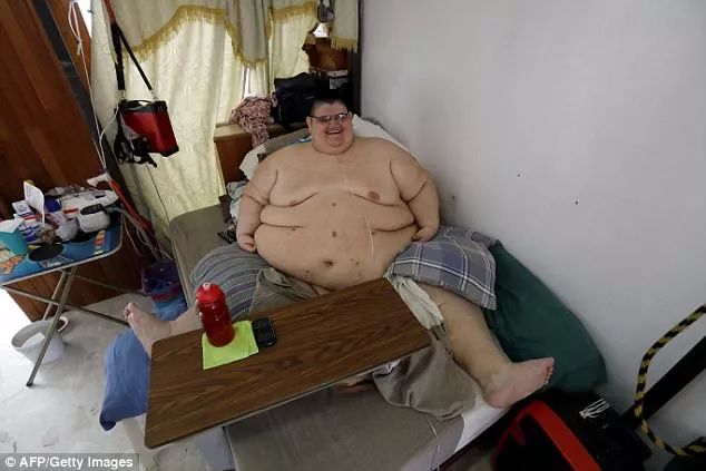 这个世界上最胖的男人减掉249公斤后终于可以下床走路了