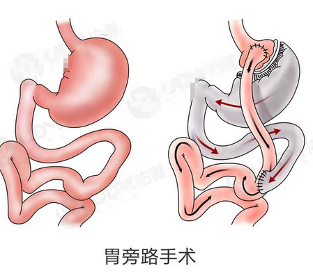 胃的原理是什么_胃左边是什么器官