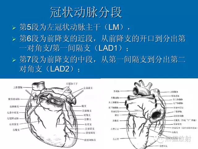冠状动脉分段方法冠状动脉cta解剖名称缩写冠状动脉分支解剖左,右
