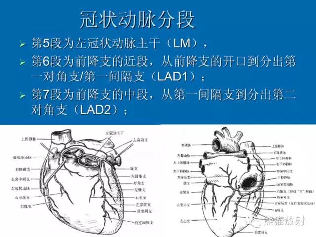 右冠状动脉介绍心脏系统解剖图