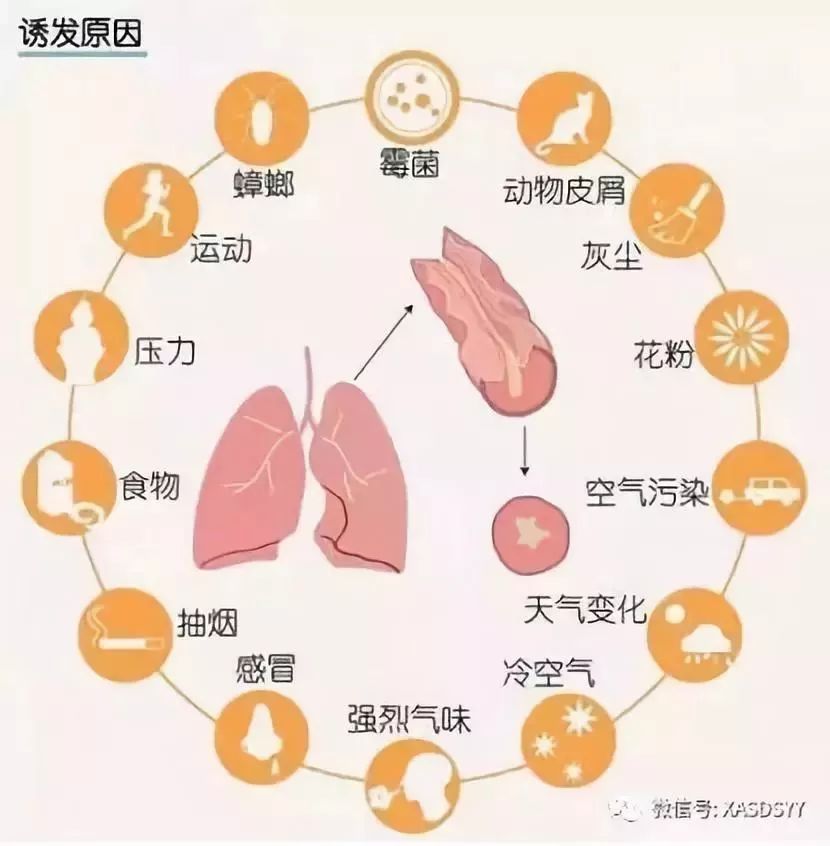 支气管哮喘是一种气道慢性炎症,也是一种过敏性炎症,对于过敏体质的