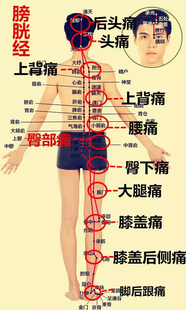 5,胆经疼痛部位6,肝疼痛部位