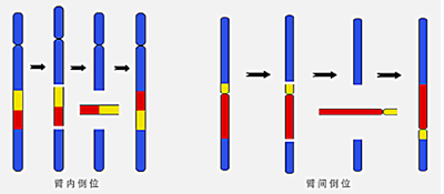 臂间倒位是指染色体的长臂和短臂各发生一次断裂,断片倒转180度后重接