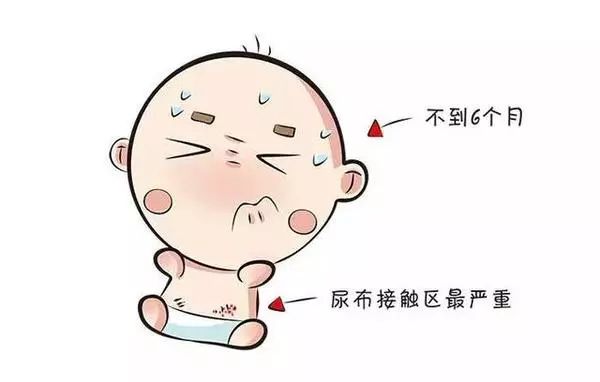 川崎病小儿皮肤黏膜淋巴结综合征mucocutaneouslymphnodesyndromemcls