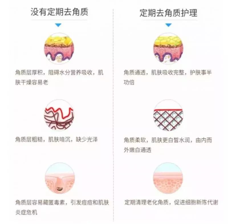 皮肤暗沉怎么办