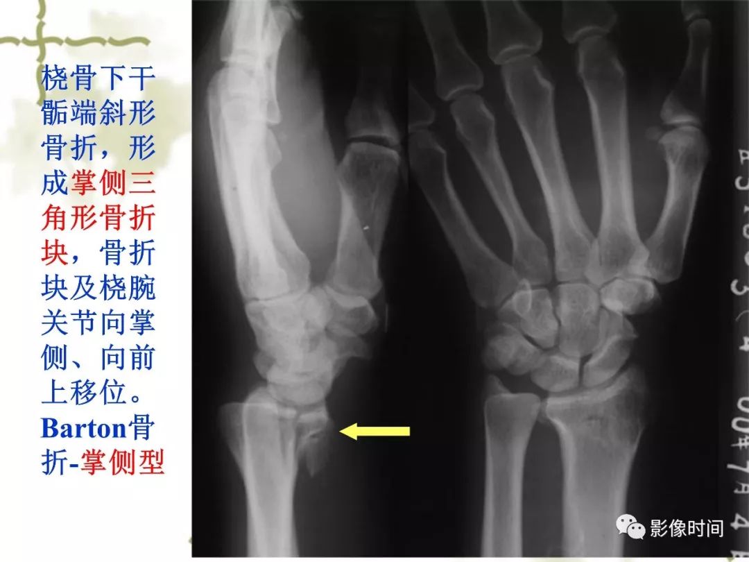 誤診率高達 91.3% 的疾病，你診斷對了嗎？ 健康 第11張