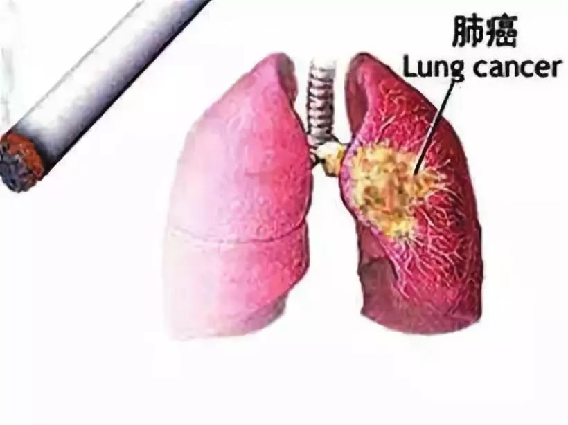 为什么有些人经常抽烟不得肺癌,却依然会长寿呢?