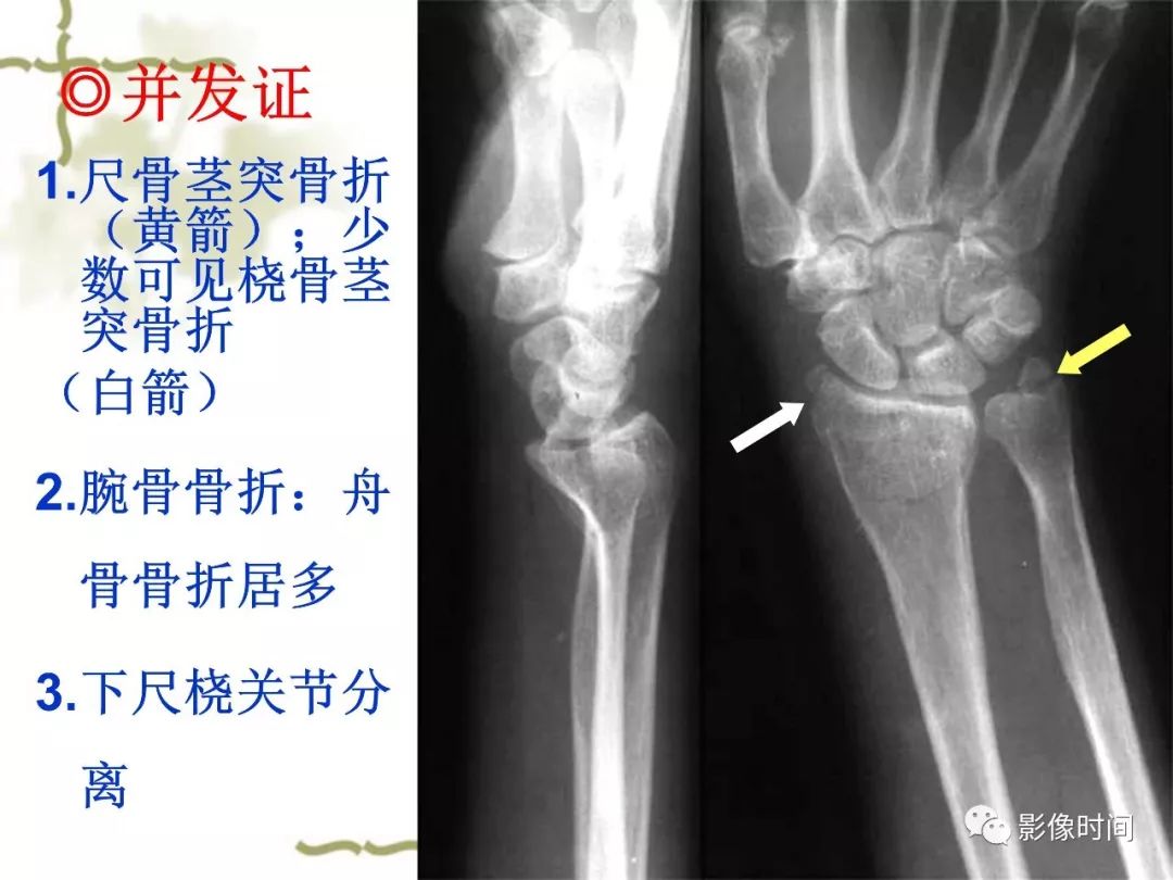 誤診率高達 91.3% 的疾病，你診斷對了嗎？ 健康 第27張