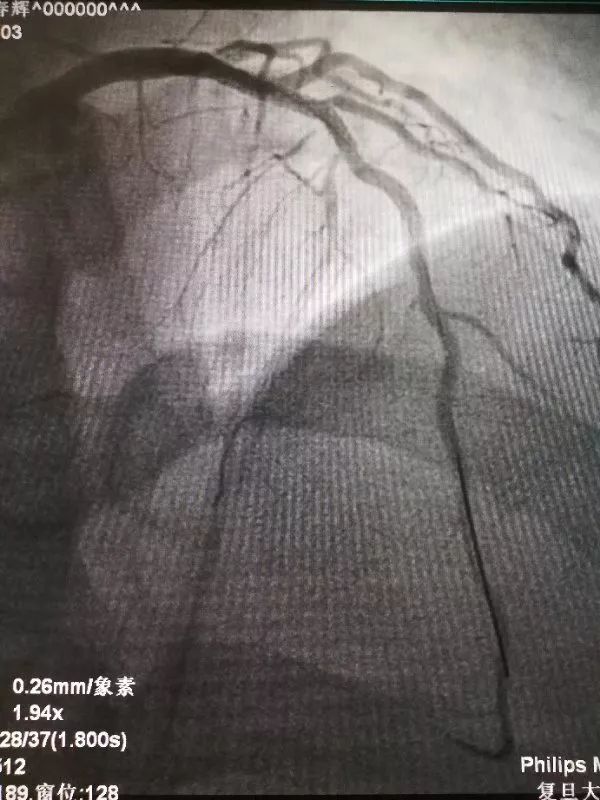 【關注】20分鐘能做什麼？ 健康 第12張