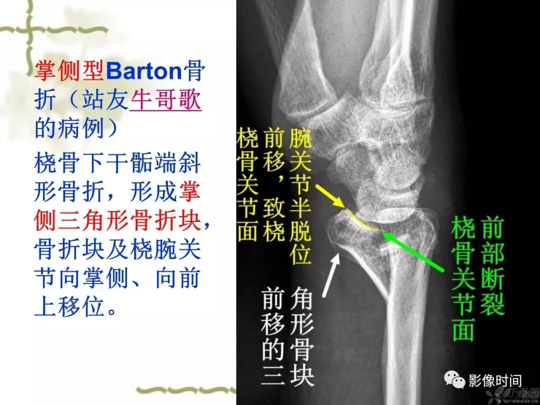 誤診率高達 91.3% 的疾病，你診斷對了嗎？ 健康 第13張