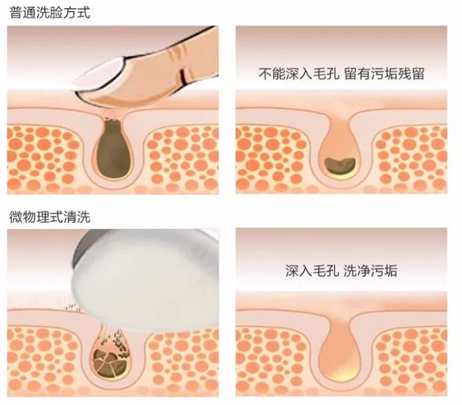 皮肤暗沉粗糙?用它洗洗,毛孔黑头全消失!