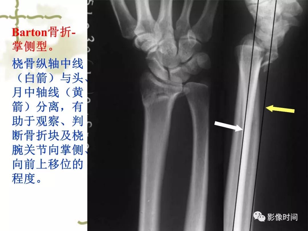 誤診率高達 91.3% 的疾病，你診斷對了嗎？ 健康 第12張