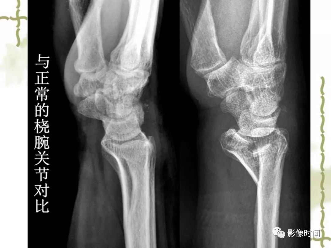 誤診率高達 91.3% 的疾病，你診斷對了嗎？ 未分類 第14張