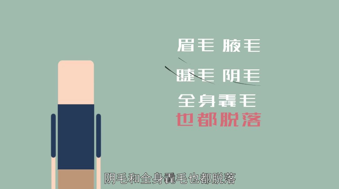 比地中海、髮際線後移更可怕的斑禿，其實是有先兆的 健康 第8張