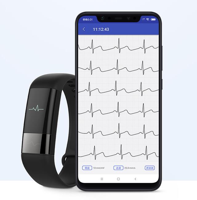 仪上市比Apple Watch更好用MG电子一键测心电可穿戴的心电记录(图5)