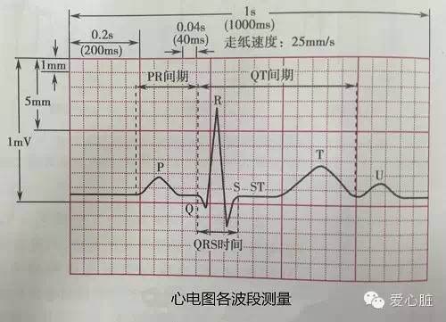 如此形象的解读你还有什么理由看不懂心电图