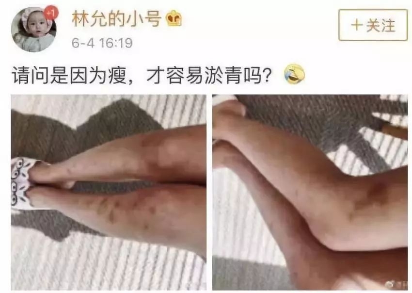 曝打人,被老男人睡,神经质,为什么她还能手握顶级资源