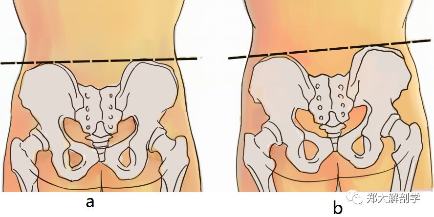 健康 正文  3 髌骨位置异常的解剖学分析 髌骨内移 股内侧肌 股直肌