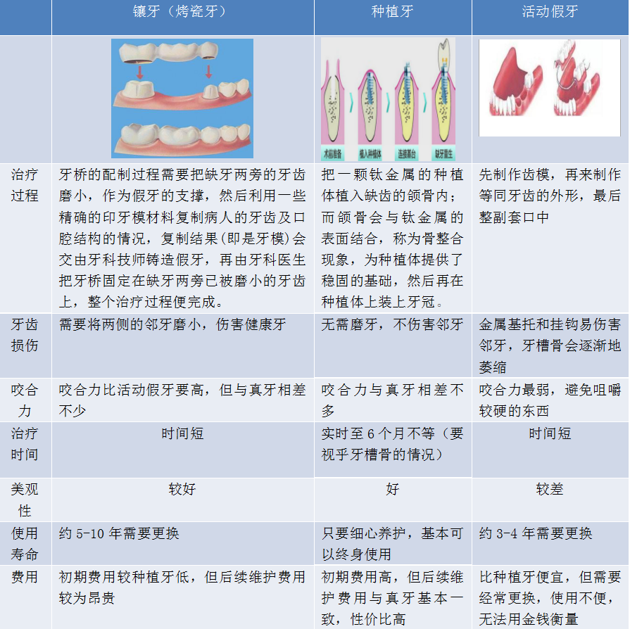 3种缺牙修复方式