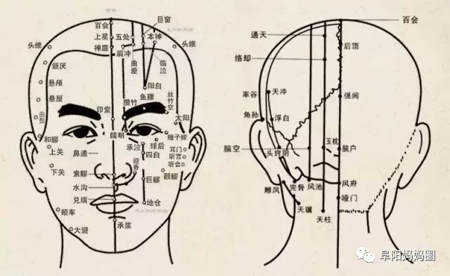 砭石梳子具有疏通经络活血化瘀改善失眠的功效