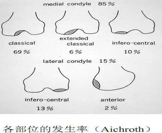 干货| 引起膝关节疼痛的22种常见疾病