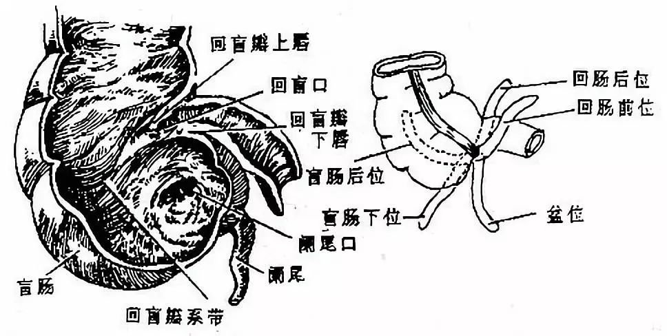 图2-22 盲肠内腔及阑尾炎结肠colon围绕在空回肠的周围,可分为升结肠