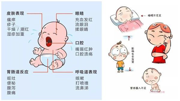 添加辅食时,如何判断宝宝过敏?_症状