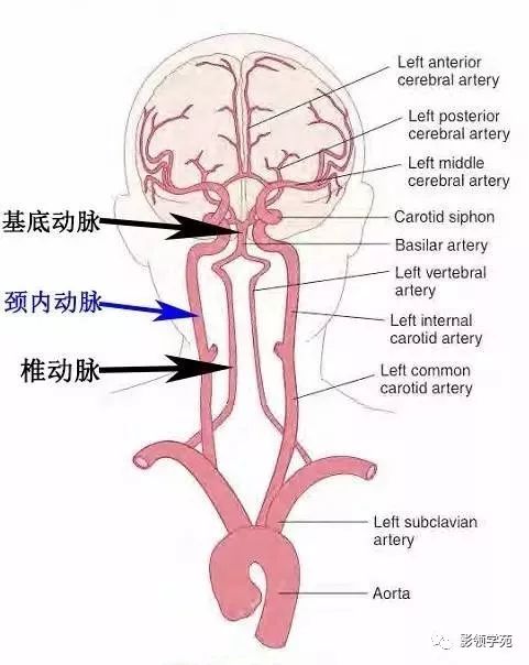 如果没有脑血管解剖的基础知识,想迅速学会读片是一件性价比非常低的