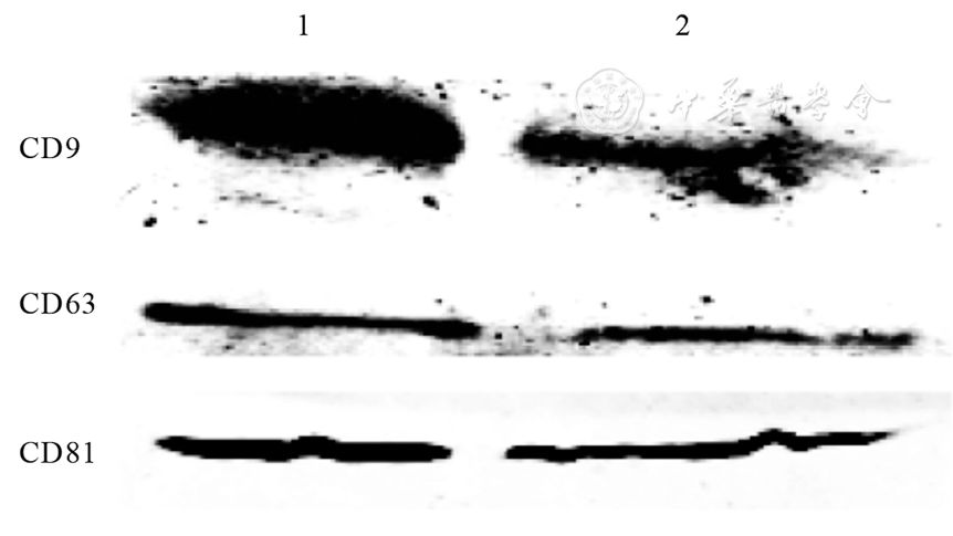 外泌体特异标志蛋白cd9,cd63和cd81的western印迹检测结果