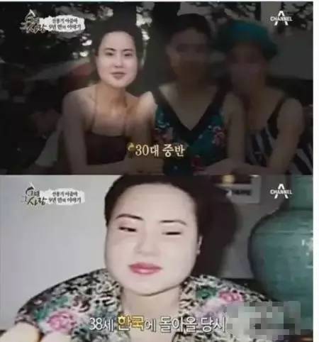 整容過度，美女慘變「電風扇大媽」，竟往臉上注射食用油 時尚 第3張