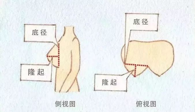 圆盘:圆盘型 底径大,隆起低,胸型像一个倒扣的盘子,不显胸.