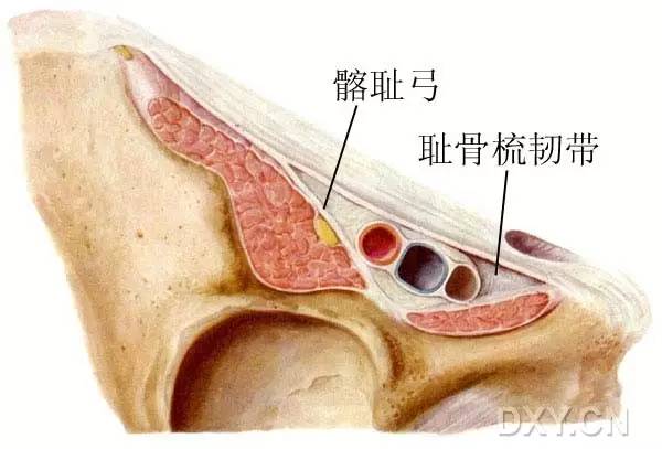 在解剖上是有争议的,但是我们在临床上可以理解是腔隙韧带(陷窝韧带)