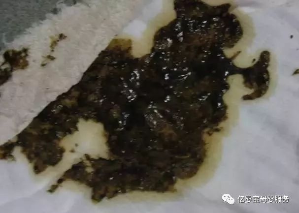 但如果大便呈灰白色,看上去像白陶土,这说明宝宝的胆道阻塞,胆汁不能