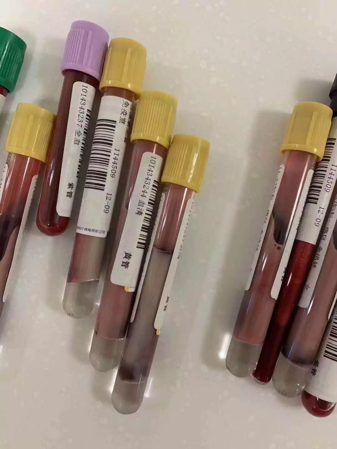 可怕！白、藍、黃，有人體檢抽出這些顏色的血！ 未分類 第1張