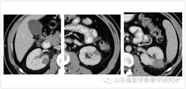 山東省醫學影像學研究所科室簡介（三）——超聲介入診療研究室 未分類 第13張