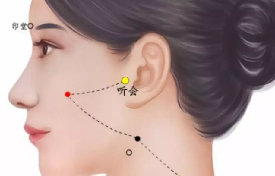 耳鸣是如何产生的这个穴位特别善于治疗耳鸣的症状