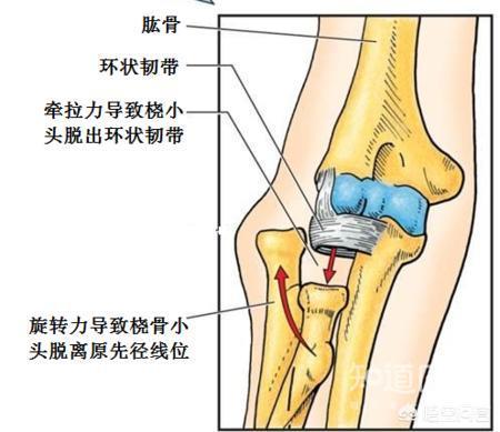 环掉怎么办