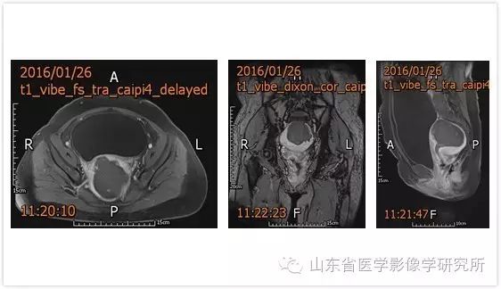 山東省醫學影像學研究所科室簡介（三）——超聲介入診療研究室 未分類 第11張