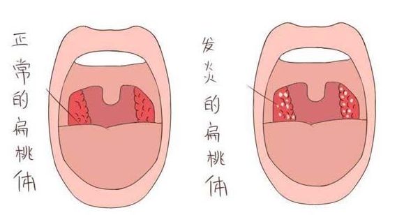 刘德华演唱会失声,医生劝他别唱了,原因竟是.