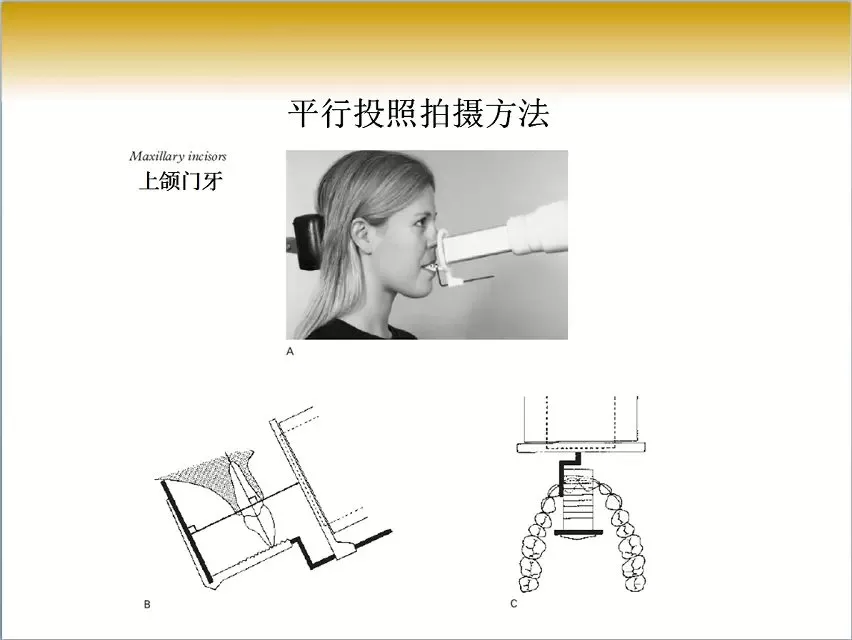 最全!口腔x线片拍摄的技巧