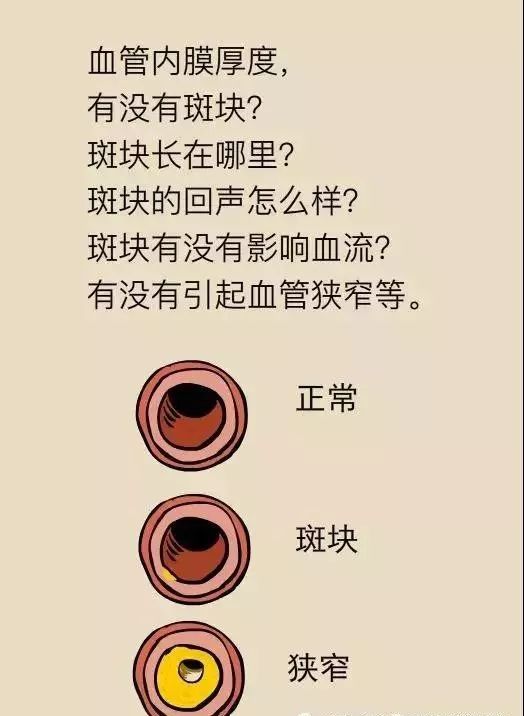 斑什么什么离成语_成语故事图片(3)