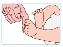 足底抓握反射图踏步反射:当婴儿被竖着抱起,把脚放在床上或平面上时