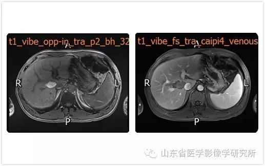 山東省醫學影像學研究所科室簡介（三）——超聲介入診療研究室 未分類 第9張