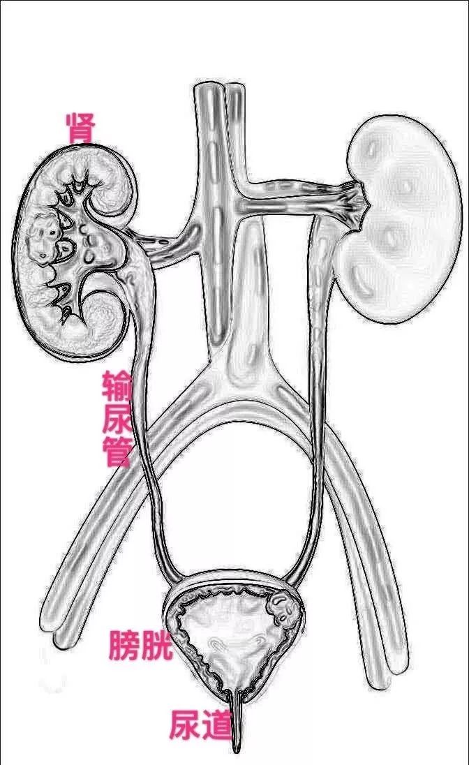 泌尿系結石系列之初識結石的奧秘 健康 第2張